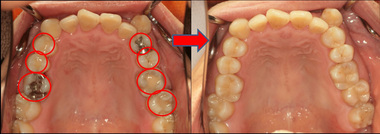 EE dentalmat (1).jpg