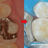 2019 EEdental BT (4).jpg