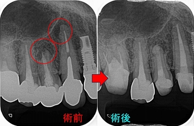 2024 EEdental HAT (1).jpg