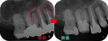 2024 EEdental HAT (2).jpg