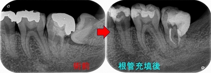 2024 EEdental MYO (2).jpg