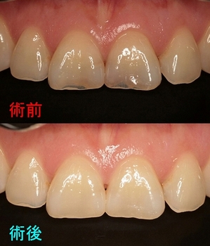 2024 EEdental FUE (1).jpg