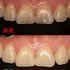 2024 EEdental FUE (1).jpg