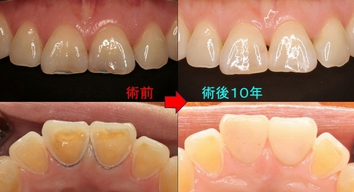 2024 EEdental FUE (2).jpg