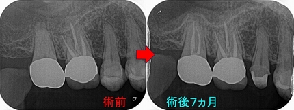 2024EEdental OHI (3).jpg