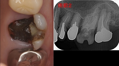 2024 EEdental FUY (2).jpg