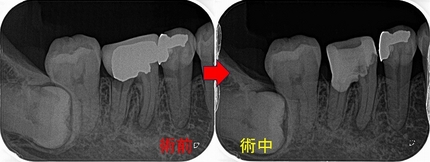 2024 EEdental TKA (2).jpg