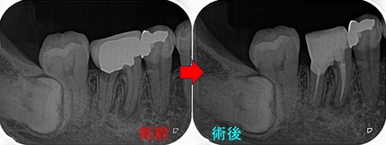 2024 EEdental TKA (3).jpg