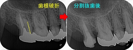 2024 EEdental YAK (2).jpg