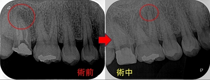 2024 EEdental IHI (1).jpg