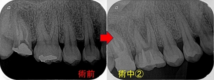 2024 EEdental IHI (2).jpg