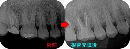 2024 EEdental IHI (3).jpg