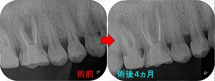 2024 EEdental IHI (4).jpg