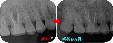 2024 EEdental IHI (5).jpg