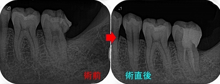 2025 EEdental TAY (2).jpg