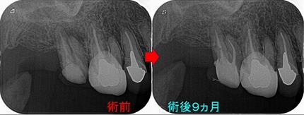 2024 EEdental TAK (6).jpg