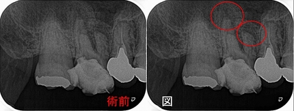 2025 EEdental HOT (1).jpg