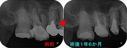 2025 EEdental HOT (4).jpg