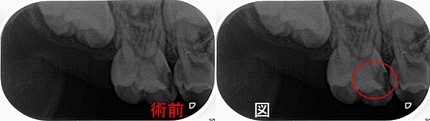 2025 EEdental INS (1).jpg