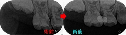 2025 EEdental INS (3).jpg