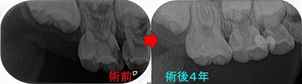 2025 EEdental INS (4).jpg