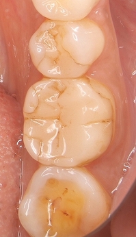 2025 EEdental TAK (2).jpg