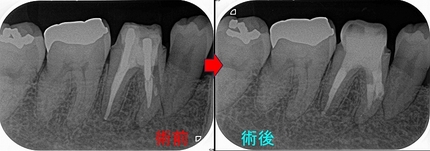2025 EEdental HIY (2).jpg