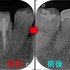 2025 EEdental HIY (2).jpg