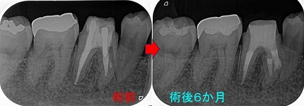 2025 EEdental HIY (3).jpg
