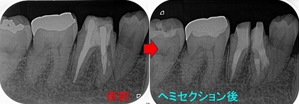 2025 EEdental HIY (4).jpg