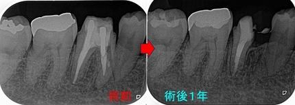 2025 EEdental HIY (5).jpg