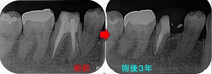 2025 EEdental HIY (6).jpg