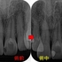 2025 EEdental TKa (2).jpg