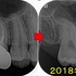 2025 EEdental FUR (1).jpg