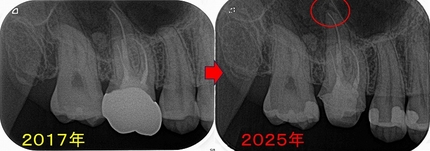2025 EEdental FUR (3).jpg