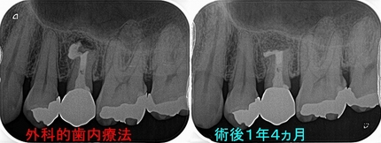 2025 EEdental HIK (0).jpg