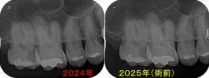 2025 EEdental HIK (3).jpg