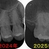 2025 EEdental HIK (3).jpg