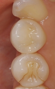 2025 EEdental HYU (1).jpg