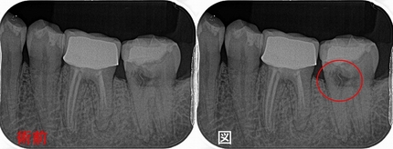 2025 EEdental IZY (1).jpg