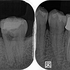 2025 EEdental IZY (1).jpg