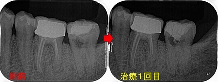 2025 EEdental IZY (2).jpg