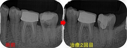 2025 EEdental IZY (3).jpg