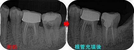 2025 EEdental IZY (4).jpg