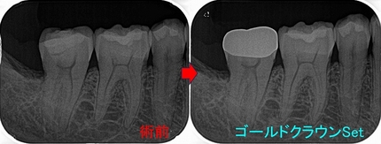 2025 EEdental IZY.jpg