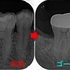 2025 EEdental IZY.jpg