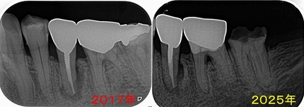 2025 EEdental NA (2).jpg