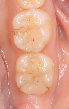 2025 EEdental OMI (3).jpg