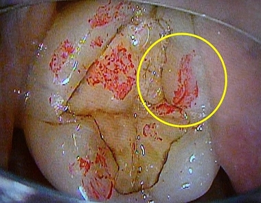 2025 EEdental OMI.jpg