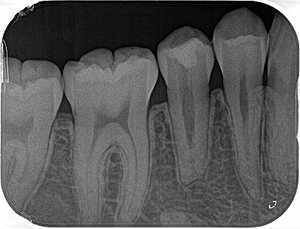 2025 EEdental MUY (０).jpg
